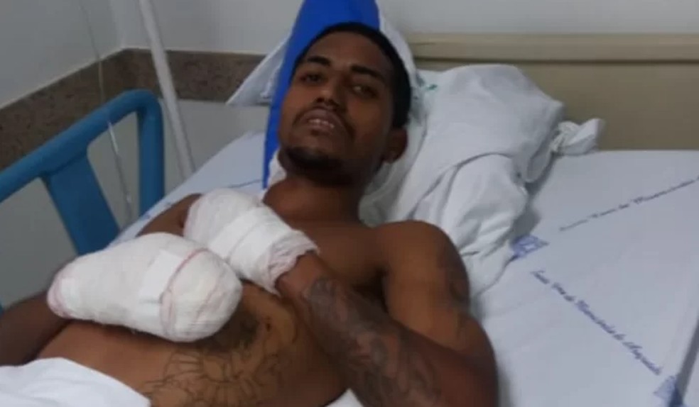 Araçatuba: ciclista que teve pés amputados em ataque a bancos não viu bomba: 'Só passou perto e explodiu', diz irmão